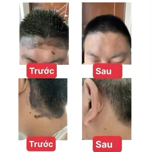 vn-11134207-820l4-mhri2hexjb4087